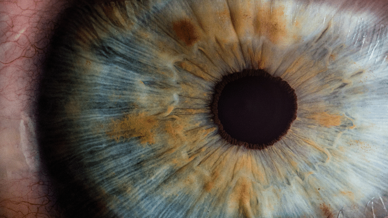 An Aging Retina Could Predict Mortality Risk